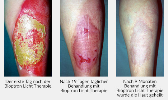 Zepter-Bioptron-12-DE